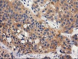 Invitrogen RTN4IP1 Monoclonal Antibody (OTI3B2) 100 &mu;L; Unconjugated:Antibodies,
