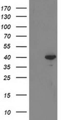 Invitrogen RTN4IP1 Monoclonal Antibody (OTI3B2) 100 &mu;L; Unconjugated:Antibodies,