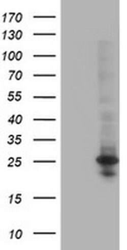 Invitrogen POLR2E Monoclonal Antibody (OTI3B5) 100 &mu;L | Buy Online | Invitrogen&trade; | Fisher Scientific