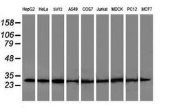 Invitrogen POLR2E Monoclonal Antibody (OTI3B5) 100 &mu;L | Buy Online | Invitrogen&trade; | Fisher Scientific