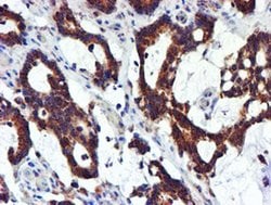 Invitrogen NDUFB9 Monoclonal Antibody (OTI13H11) 100 &mu;L; Unconjugated:Antibodies,