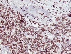 Invitrogen HOXC11 Monoclonal Antibody (OTI3E10) 100 &mu;L; Unconjugated:Antibodies,