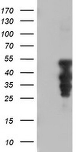 Invitrogen HOXC11 Monoclonal Antibody (OTI2H9) 100 &mu;L; Unconjugated:Antibodies,