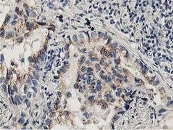 Invitrogen LACTB2 Monoclonal Antibody (OTI1A8) 100 &mu;L; Unconjugated:Antibodies,