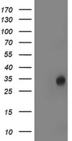 Invitrogen LACTB2 Monoclonal Antibody (OTI1A8) 100 &mu;L; Unconjugated:Antibodies,