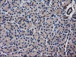 Invitrogen ARFGAP1 Monoclonal Antibody (OTI1F6) 100 &mu;L; Unconjugated:Antibodies,