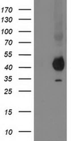 Invitrogen PON1 Monoclonal Antibody (OTI1F7) 100 &mu;L; Unconjugated:Antibodies,