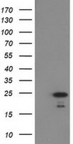 Invitrogen HDHD1 Monoclonal Antibody (OTI2E10) 100 &mu;L | Buy Online | Invitrogen&trade; | Fisher Scientific