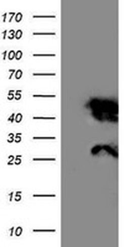 Invitrogen NNMT Monoclonal Antibody (OTI3D8) 100 &mu;L; Unconjugated:Antibodies,