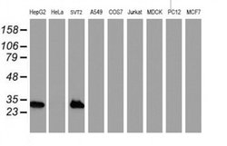 Invitrogen NNMT Monoclonal Antibody (OTI3D8) 100 &mu;L; Unconjugated:Antibodies,