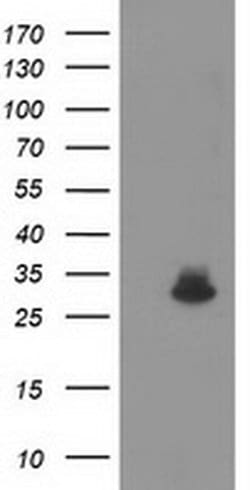 Invitrogen KCTD14 Monoclonal Antibody (OTI3F5) 100 &mu;L; Unconjugated:Antibodies,
