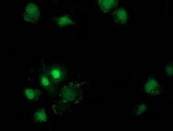 Invitrogen Destrin Monoclonal Antibody (OTI1D8) 100 &mu;L; Unconjugated:Antibodies,