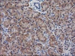 Invitrogen Destrin Monoclonal Antibody (OTI1D8) 100 &mu;L; Unconjugated:Antibodies,