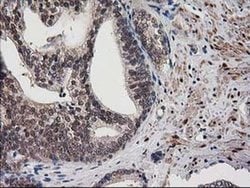Invitrogen Destrin Monoclonal Antibody (OTI1D8) 100 &mu;L; Unconjugated:Antibodies,