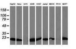 Invitrogen Destrin Monoclonal Antibody (OTI1D8) 100 &mu;L; Unconjugated:Antibodies,