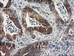 Invitrogen SULT1C2 Monoclonal Antibody (OTI5A4) 100 &mu;L; Unconjugated:Antibodies,