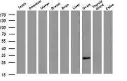Invitrogen HAND1 Monoclonal Antibody (OTI1G10) 100 &mu;L; Unconjugated:Antibodies,