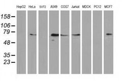 Invitrogen MGRN1 Monoclonal Antibody (OTI3C3) 100 &mu;L; Unconjugated:Antibodies,