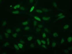 Invitrogen ECRG4 Monoclonal Antibody (OTI3B10) 100 &mu;L; Unconjugated:Antibodies,
