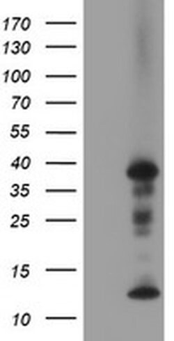 Invitrogen PDLIM2 Monoclonal Antibody (OTI10C4) 100 &mu;L; Unconjugated:Antibodies,
