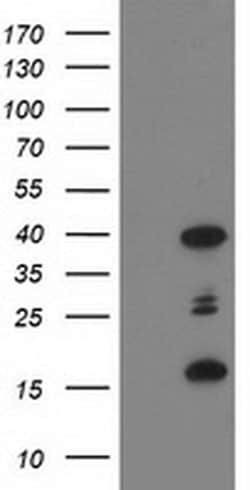 Invitrogen PDLIM2 Monoclonal Antibody (OTI1D12) 100 &mu;L; Unconjugated:Antibodies,