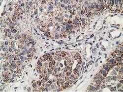 Invitrogen SSX1 Monoclonal Antibody (OTI1E10) 100 &mu;L; Unconjugated:Antibodies,