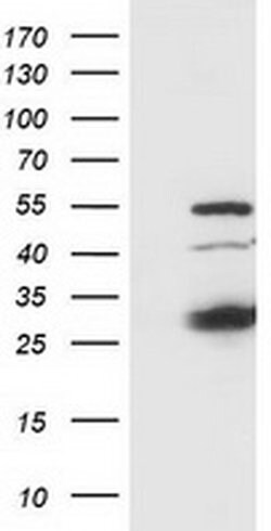Invitrogen SSX1 Monoclonal Antibody (OTI1E10) 100 &mu;L; Unconjugated:Antibodies,