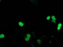 Invitrogen SSX1 Monoclonal Antibody (OTI2E9) 100 &mu;L; Unconjugated:Antibodies,