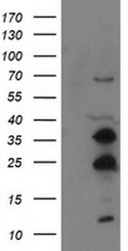 Invitrogen SSX1 Monoclonal Antibody (OTI2E9) 100 &mu;L; Unconjugated:Antibodies,