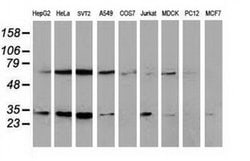 Invitrogen SSX1 Monoclonal Antibody (OTI2E9) 100 &mu;L; Unconjugated:Antibodies,