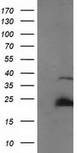 Invitrogen SSX1 Monoclonal Antibody (OTI2F8) 100 &mu;L | Buy Online | Invitrogen&trade; | Fisher Scientific