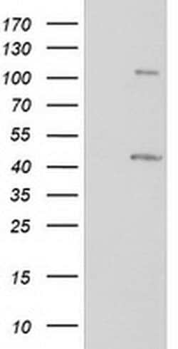 Invitrogen PRKAR1B Monoclonal Antibody (OTI2A3) 100 &mu;L; Unconjugated:Antibodies,