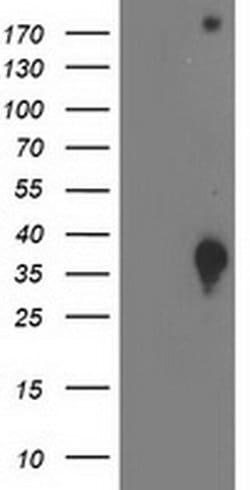 Invitrogen DNAJB2 Monoclonal Antibody (OTI4D12) 100 &mu;L; Unconjugated:Antibodies,