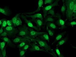 Invitrogen Alcohol Dehydrogenase 1B Monoclonal Antibody (OTI4F12) 100 &mu;L;