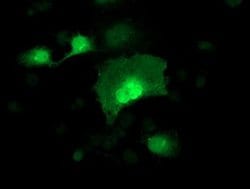 Invitrogen Alcohol Dehydrogenase 1B Monoclonal Antibody (OTI4F12) 100 &mu;L;