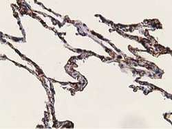 Invitrogen Alcohol Dehydrogenase 1B Monoclonal Antibody (OTI4F12) 100 &mu;L;
