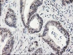 Invitrogen Alcohol Dehydrogenase 1B Monoclonal Antibody (OTI4F12) 100 &mu;L;