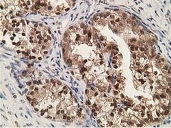 Invitrogen Alcohol Dehydrogenase 1B Monoclonal Antibody (OTI4F12) 100 &mu;L;