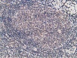 Invitrogen Alcohol Dehydrogenase 1B Monoclonal Antibody (OTI4F12) 100 &mu;L;