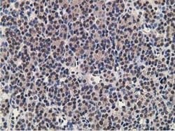 Invitrogen Alcohol Dehydrogenase 1B Monoclonal Antibody (OTI4F12) 100 &mu;L;