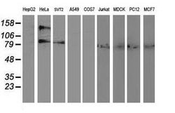 Invitrogen Alcohol Dehydrogenase 1B Monoclonal Antibody (OTI4F12) 100 &mu;L;