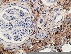 Invitrogen Alcohol Dehydrogenase 1B Monoclonal Antibody (OTI5D7) 100 &mu;L;