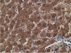 Invitrogen Alcohol Dehydrogenase 1B Monoclonal Antibody (OTI5D7) 100 &mu;L;