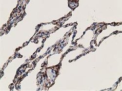 Invitrogen Alcohol Dehydrogenase 1B Monoclonal Antibody (OTI5D7) 100 &mu;L;