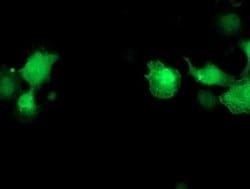 Invitrogen PNMT Monoclonal Antibody (OTI1D2) 100 &mu;L; Unconjugated:Antibodies,