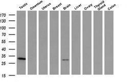 Invitrogen PNMT Monoclonal Antibody (OTI1D2) 100 &mu;L; Unconjugated:Antibodies,