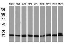 Invitrogen PNMT Monoclonal Antibody (OTI1D2) 100 &mu;L; Unconjugated:Antibodies,