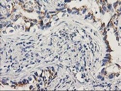Invitrogen PNMT Monoclonal Antibody (OTI2D5) 100 &mu;L; Unconjugated:Antibodies,