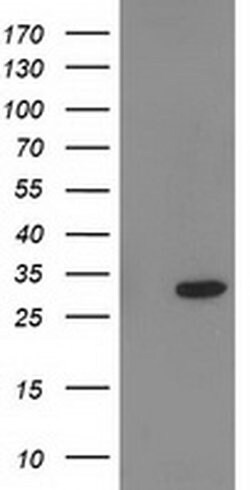 Invitrogen PNMT Monoclonal Antibody (OTI2D5) 100 &mu;L; Unconjugated:Antibodies,