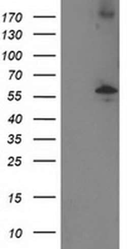 Invitrogen PPM1B Monoclonal Antibody (OTI3E10) 100 &mu;L; Unconjugated:Antibodies,